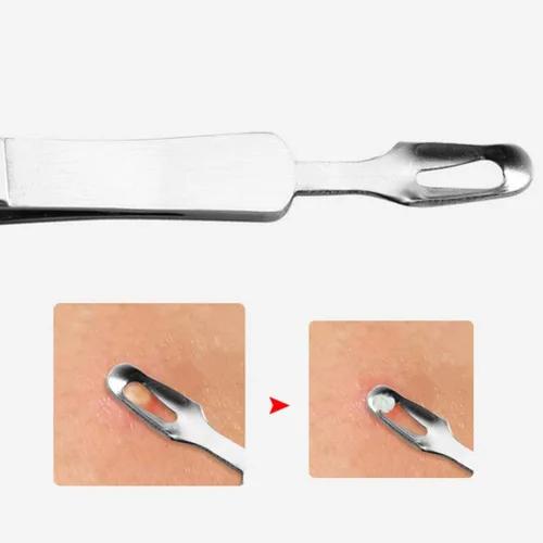 Miniatura 9 de Precisión de precisión de precisión 3 unids espinilla curvada punta de acero Comedone Splinter Extractor herramienta herramienta herramienta