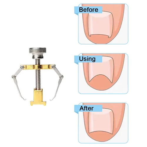 Miniatura 6 de Corrector de uñas encarnadas profesional encarnadas levantador de uñas encarnadas práctica abrazadera para el tratamiento de uñas encarnadas