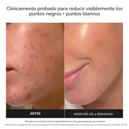 Miniatura 4 de Paula's Choice SKIN PERFECTING 2% BHA Liquid Exfoliant with Salicylic Acid, Facial Polish for Pores, Wrinkles & Fine Lines, Suitable for