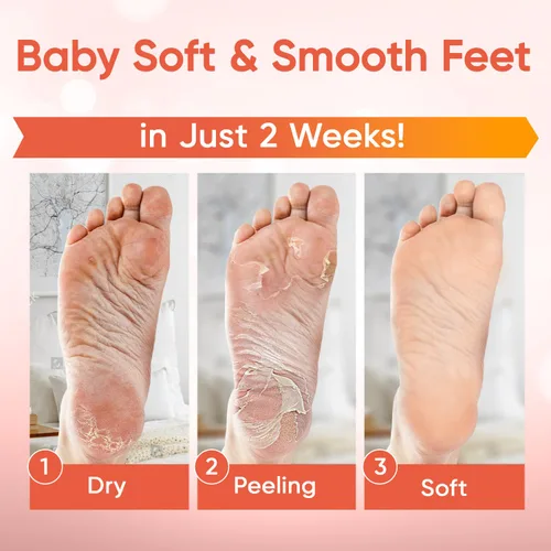 Miniatura 2 de Máscara exfoliante para pies - Máscara para pies con piel suave como la de un bebé - Elimina la piel muerta, pies secos, agrietados y callos, spa