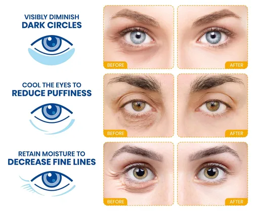 Miniatura 3 de Stylia Parches para usar debajo de los ojos para ojos hinchados y ojeras (20 pares) – Mascarilla de oro de 24 quilates para usar debajo de los ojos