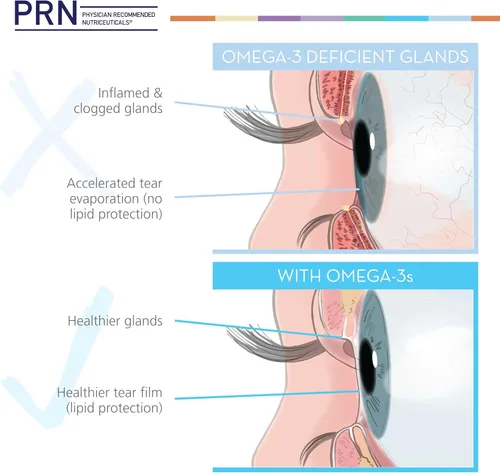 Miniatura 6 de PRN DE Omega Beneficios (fórmula líquida) - Soporte avanzado para la sequedad ocular - 2240 mg de suplemento EPA y DHA en forma de triglicérido