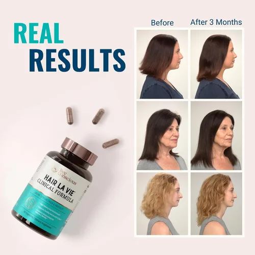 Miniatura 3 de Hair La Vie Live Conscious - Vitaminas clínicas para el crecimiento del cabello para mujeres y hombres con biotina, colágeno y palma enana americana