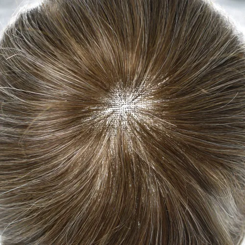 Miniatura 31 de Sistema de repuesto de cabello humano europeo con encaje frontal suizo para hombre, tupé para hombre, pieza de cabello, nudo blanqueado, línea #17