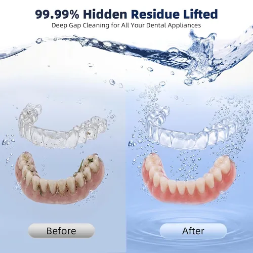 Miniatura 6 de Máquina limpiadora ultrasónica de retenedores, limpiador de dentaduras para alineadores, protectores nocturnos, protectores bucales, cabezales