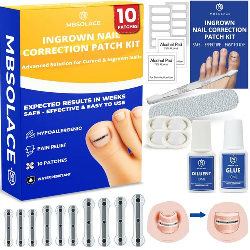 Kit de tratamiento y corrector de uñas encarnadas de aleación de titanio de alta calidad, tiras correctoras hipoalergénicas para uñas de los pies,