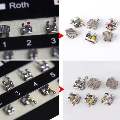 Miniatura 5 de VEZE Soportes dentales, 5 juegos de 100 piezas Mini Roth 022 ranura 345 ganchos, unido, compatible con MBT, unisex, uso en interiores, tema de salud