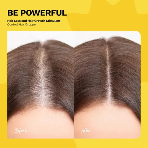 Miniatura 5 de Ginger Milk Natural Care Extracto de raíz de jengibre Suero para el crecimiento del cabello y gotas estimulantes del crecimiento para el control