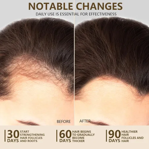 Miniatura 4 de Aceite de batana crudo 100% natural para el crecimiento del cabello, sin refinar y orgánico Dr Sebi aceite para el crecimiento del cabello