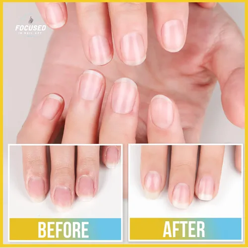 Miniatura 5 de Teenitor Kit removedor de cutículas con removedor de cutículas, aceite de lima de uñas, pulidor de cutículas, empujador de cutículas, raspador