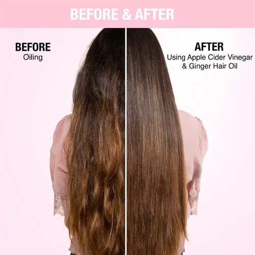 Miniatura 6 de Acondicionador - Apunta la sequedad y bloquea la humedad para todo tipo de cabello - aclara tu cuero cabelludo - Combate la caspa y suaviza