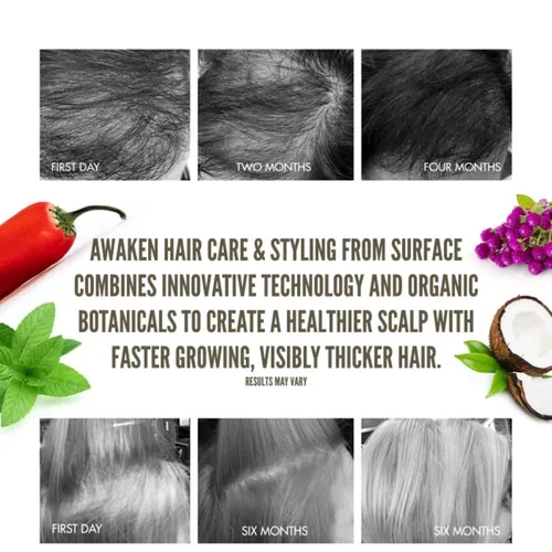 Miniatura 6 de Surface Hair Kit Awaken: champú, acondicionador, elixir de cuero cabelludo y tratamiento terapéutico - para adelgazar el cabello, pérdida de cabello