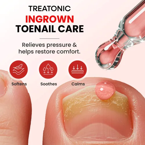 Miniatura 5 de Treatonic Kit de Tratamiento de Uñas Encarnadas – Gotas Suavizantes de Uñas y Conjunto de Cortaúñas de Precisión para Eliminación para el Cuidado