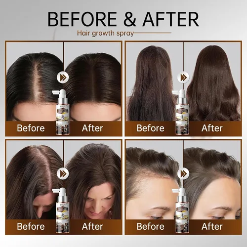 Miniatura 5 de PKU Aerosol para el crecimiento del cabello, suero capilar con biotina y aceite de romero, cuidado nutritivo del cuero cabelludo para adelgazar