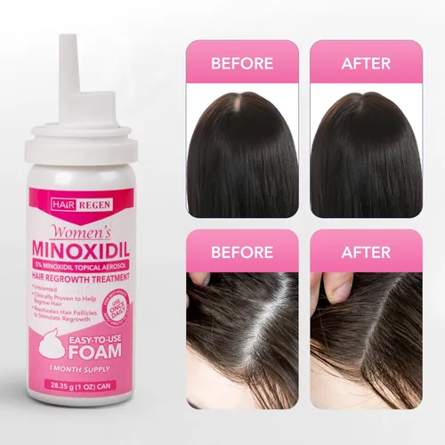 Miniatura 9 de Hair Regen Minoxidil Foam para mujeres 5% - Tratamiento de crecimiento del cabello para mujer - Minoxidil espumoso tópico para mujeres - Ideal
