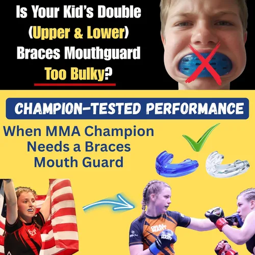 Miniatura 4 de ORAL MART Protectores bucales juveniles para deportes (transparente puro) para niños, ajuste instantáneo (sin hervir), doble (superior e inferior)