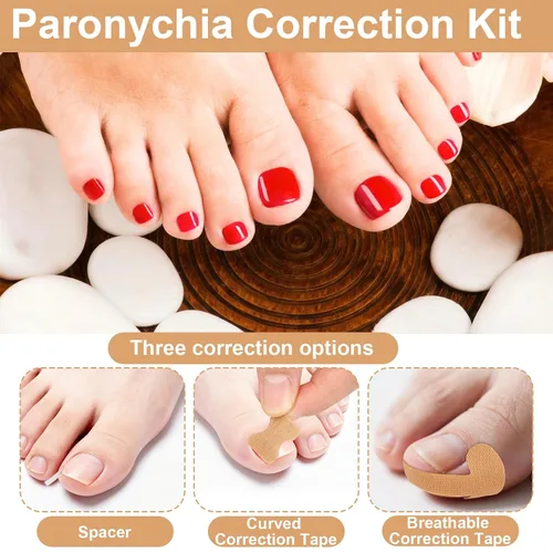 Miniatura 3 de Kit de 16 piezas de uñas encarnadas, con tiras transpirables para uñas de los pies en crecimiento, corrección de dedos curvos, parches de yeso sin