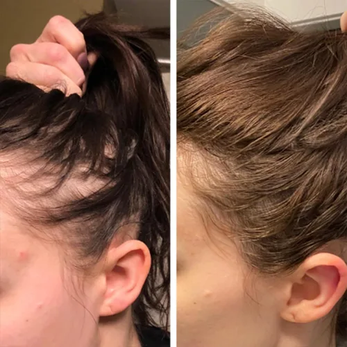 Miniatura 8 de Biotin - Suero para el crecimiento del cabello para el tratamiento de la pérdida y el crecimiento del cabello, aceite esencial de jengibre natural