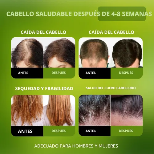 Miniatura 2 de Aceite de Batana para el Crecimiento del Cabello - Aceite de Batana 100% Crudo y Orgánico Sin Refinar - Mascarilla Capilar Prensada en Frío