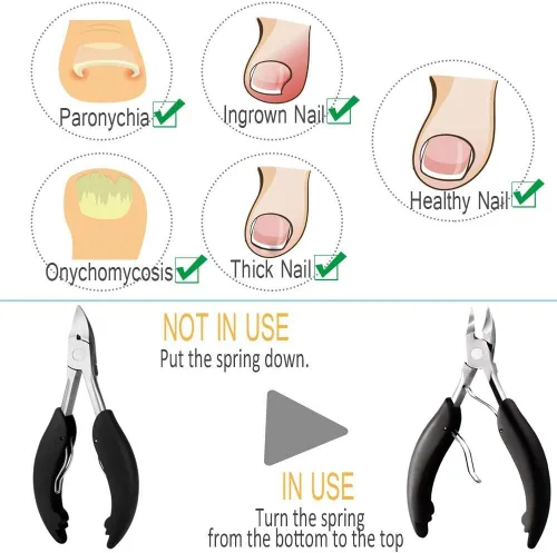 Miniatura 5 de Cortaúñas para dedos de los pies para uñas encarnadas o gruesas, recortador de uñas de los pies y podólogo profesional para personas mayores