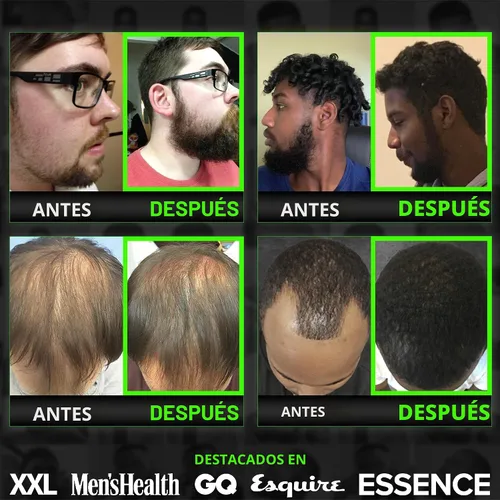 Miniatura 5 de Suero para el Crecimiento de la Barba - GROW Maximum XXL Aceite para el Crecimiento de la Barba para Hombres - Engrosa y Rellena Espacios Vacíos