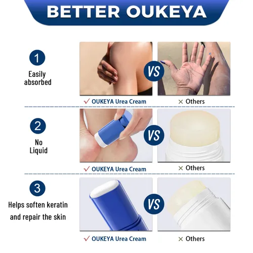 Miniatura 6 de OUKEYA Crema de urea 40 por ciento. Barra de crema de urea para pies y manos para talón agrietado seco, agrietado, evitar la congelación, loción