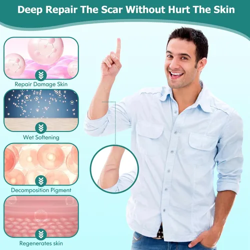 Miniatura 7 de Gowgaw Gel para cicatrices, crema para cicatrices, gel avanzado para cicatrices quirúrgicas, cara, cuerpo, pierna, quemaduras, acné, cesárea