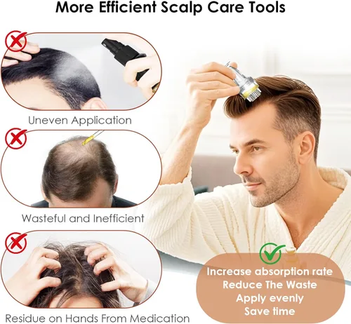 Miniatura 3 de Aplicador de minoxidil y masajeador del cuero cabelludo para el crecimiento del cabello, entrega de raíces de precisión para absorción profunda