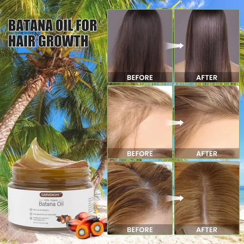 Miniatura 3 de SOVONCARE Aceite de batana crudo para el crecimiento natural del cabello Dr. Sebi orgánico de Honduras, aceite de batana 100 % puro que promueve