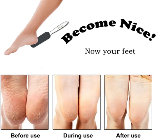 Miniatura 7 de Lima de pedicura profesional para pies – Reutilizable de acero inoxidable agrietado callos de la piel removedor de callos