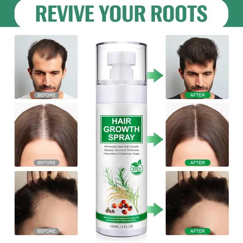 Miniatura 9 de Spray de suero para el crecimiento del cabello, spray natural para el crecimiento del cabello con biotina, batana, romero y aceite de ricino