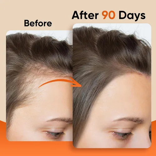 Miniatura 4 de Aceite de batana para el cabello, 100% crudo, prensado en frío, sin refinar y orgánico - Previene la pérdida de cabello, mejora el grosor
