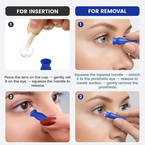 Miniatura 4 de [Paquete de 12] Insertador y removedor de lente escleral azul, aplicador de lentes de contacto de silicona sin ventilación para ojos duros, RGP