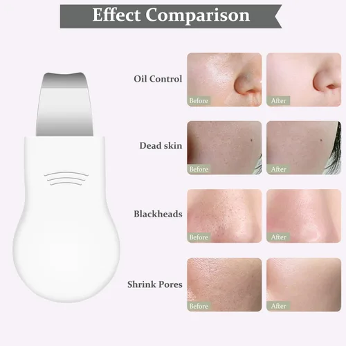 Miniatura 6 de Herramienta removedor de puntos negros, limpiador facial de silicona, raspador de poros de nariz 2 en 1 para limpieza profunda, espátula de piel