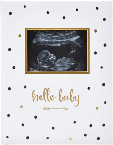 Miniatura 8 de Pearhead Hello Baby - Álbum de fotos para bebé, libro de recuerdos para nuevos y futuros padres, accesorio para bebé de género neutro, regalo ideal