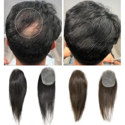 Miniatura 3 de Parche para el cabello de piel ultrafina para hombres con calvicie, unidad de reemplazo de cabello para puntos calvos, parche de piel de aspecto #1B