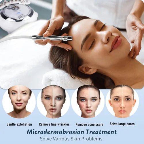 Miniatura 2 de Máquina de diamante 3 en 1, Yofuly 65-68cmHg con potencia de succión profesional, equipo de diamante para el cuidado facial de la piel