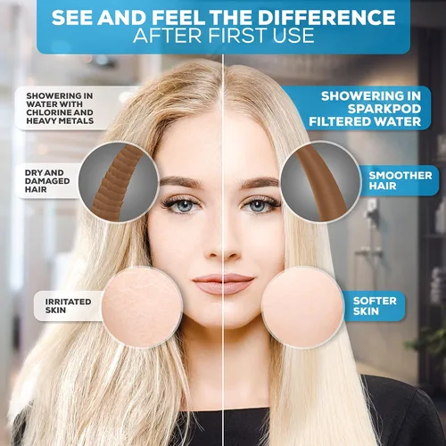 Miniatura 3 de SparkPod Cabezal de ducha filtrado de 23 etapas con 3 ajustes de pulverización, cabezal de ducha de alta presión con filtros para cabello y piel