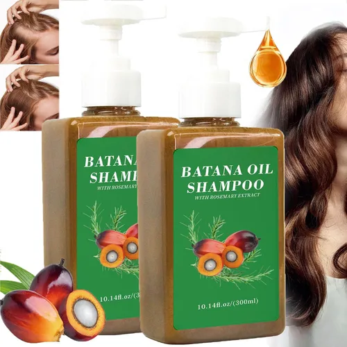 Champú de aceite de Batana,Aceite de batana para el crecimiento del cabello,Champú DeBatana Para La Caida Del Cabello,Champús contra la pérdida de