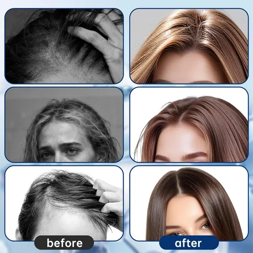 Miniatura 5 de Suero botánico 5 en 1 para el cabello Roll-On con romero, Redensyl y Anagain – Fórmula nutritiva para el cuero cabelludo para adelgazar el cabello