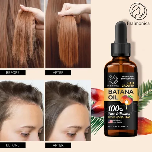 Miniatura 2 de Suero de crecimiento del cabello con aceite de batana 100% puro: suero natural para cabello más grueso y fuerte, aceite eficaz para el crecimiento