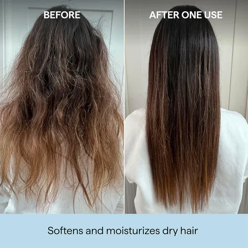Miniatura 3 de Briogeo Scalp Revival Rosemary Pre-Wash Oil Moisturizing Scalp Treatment for Dry, Flaky, or Itchy Scalp Strengthens Hair & Soothes Scalp Vegan