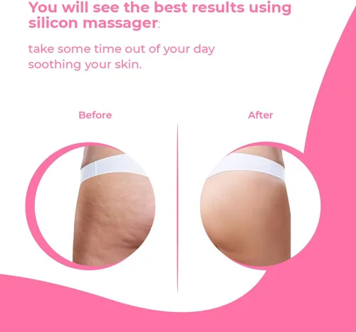 Miniatura 7 de Rodillo masajeador anticelulitis – Anticelulitis Fascia Blaster para eliminar la celulitis – Mejora el flujo sanguíneo, utiliza cepillo