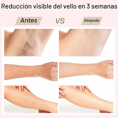 Miniatura 7 de Depilación Láser, BoSidin Depilación IPL con Enfriamiento de Hielo Sin Dolor, Rejuvenecimiento Facial SR 2 en 1, 6+1 Modos, 6 Niveles de Depilación