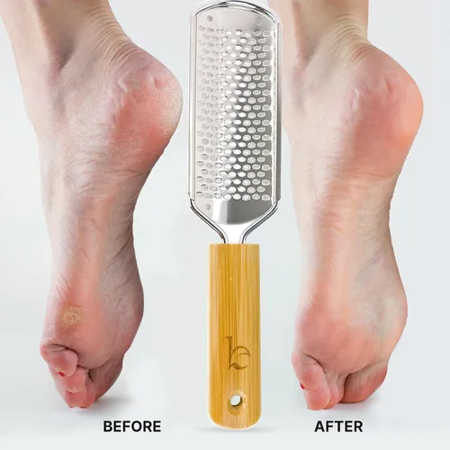 Miniatura 2 de Lima de pies – Herramienta para eliminar callos para la piel muerta, herramientas de pedicura en casa, raspador de pies y talones, pies suaves