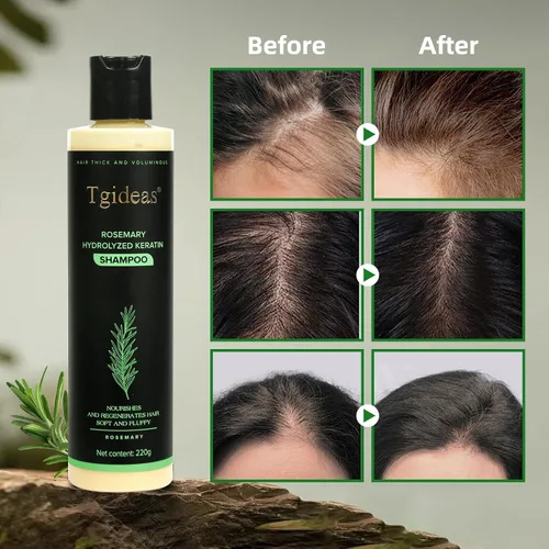 Miniatura 3 de Tgideas Champú de romero y biotina - Voluminizador, sin sulfato, para cabello fino, seco y dañado, vegano, seguro para el color, 14.8 fl oz