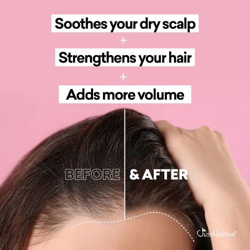 Miniatura 4 de Grow New Hair Treatment Aceite para el crecimiento del cabello Cuidado natural del cabello Tratamiento para el crecimiento del cabello