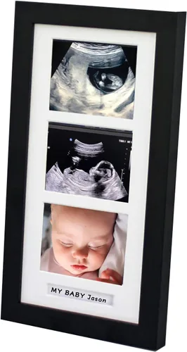 Marcos de fotos de ultrasonido triple, marco de fotos de sonograma, 3 fotos, anuncios de embarazo, regalos de embarazo para madres primerizas, Negro