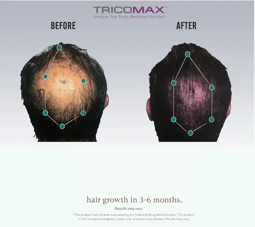 Miniatura 7 de Tricomax Suplemento para el crecimiento del cabello, apoya el cabello más grueso, más lleno y reduce la caída, ingredientes clínicamente estudiados