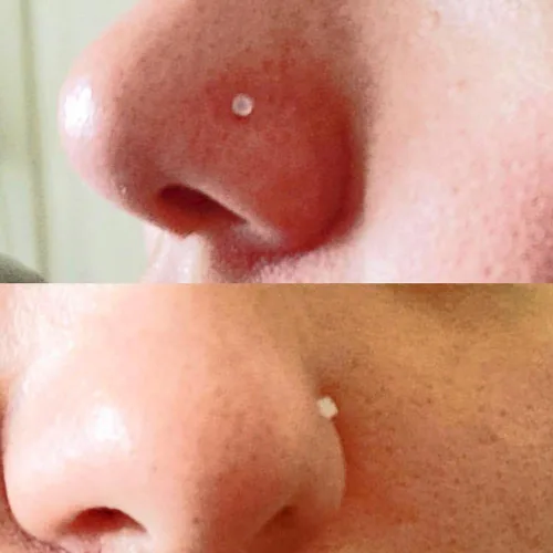 Miniatura 2 de Anillo de nariz transparente Bioflex, aretes de nariz en forma de L, sacacorchos para la nariz, piercing para el cuerpo, conjunto de joyas